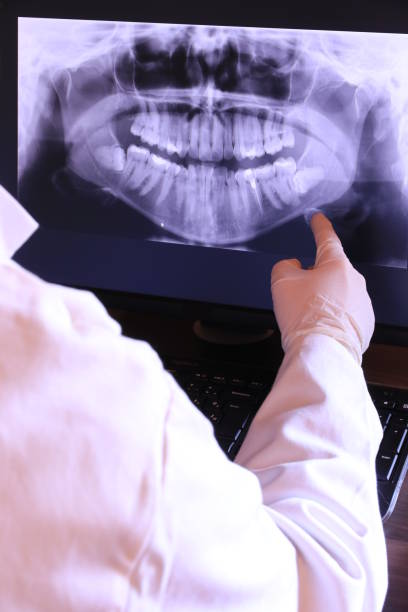 Best Emergency Root Canal Therapy in Coronita, CA