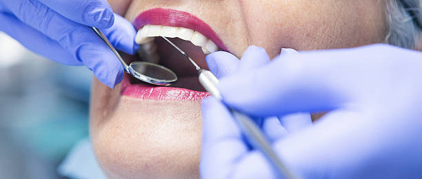 Reliable CA Emergency Dental Service Solutions